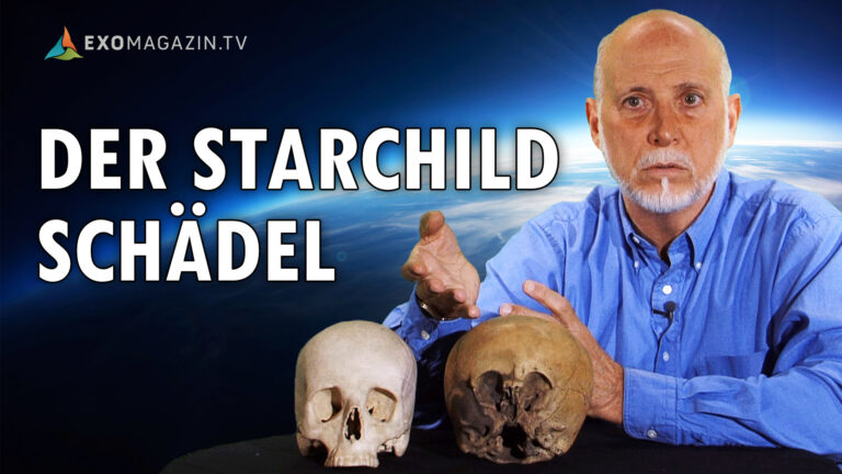 Der Starchild-Schädel